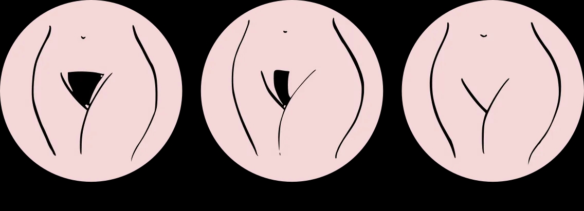 Bikini płytkie – co obejmuje i jak różni się od głębokiego?