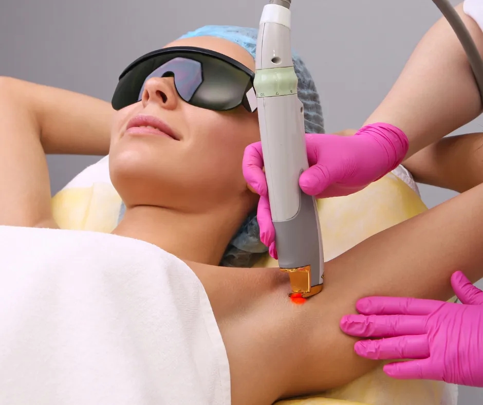 Czy po depilacji laserowej można się opalać? Uniknij powikłań!