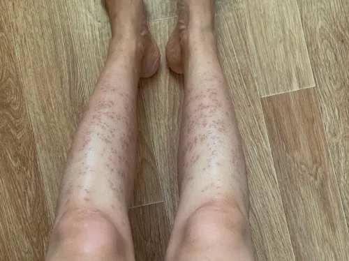 Jak pielęgnować skórę po depilacji depilatorem, aby uniknąć podrażnień