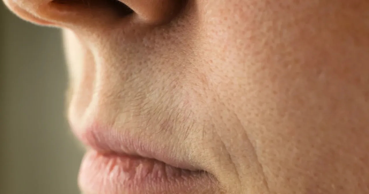 Jak usunąć wąsik żeby nie odrastał - skuteczne metody na zawsze