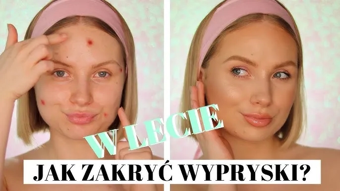 Jak dobrze zakryć pryszcza i uniknąć widocznych niedoskonałości
