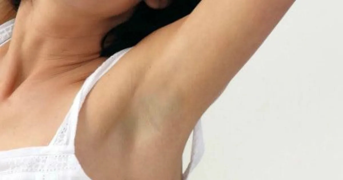 Guzek pod pachą czym smarować: skuteczne metody na ulgę i leczenie